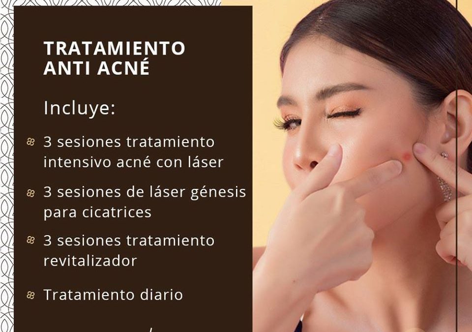 ¿Te has cansado de sufrir por el acné?, tratamiento intensivo con el Láser Génesis